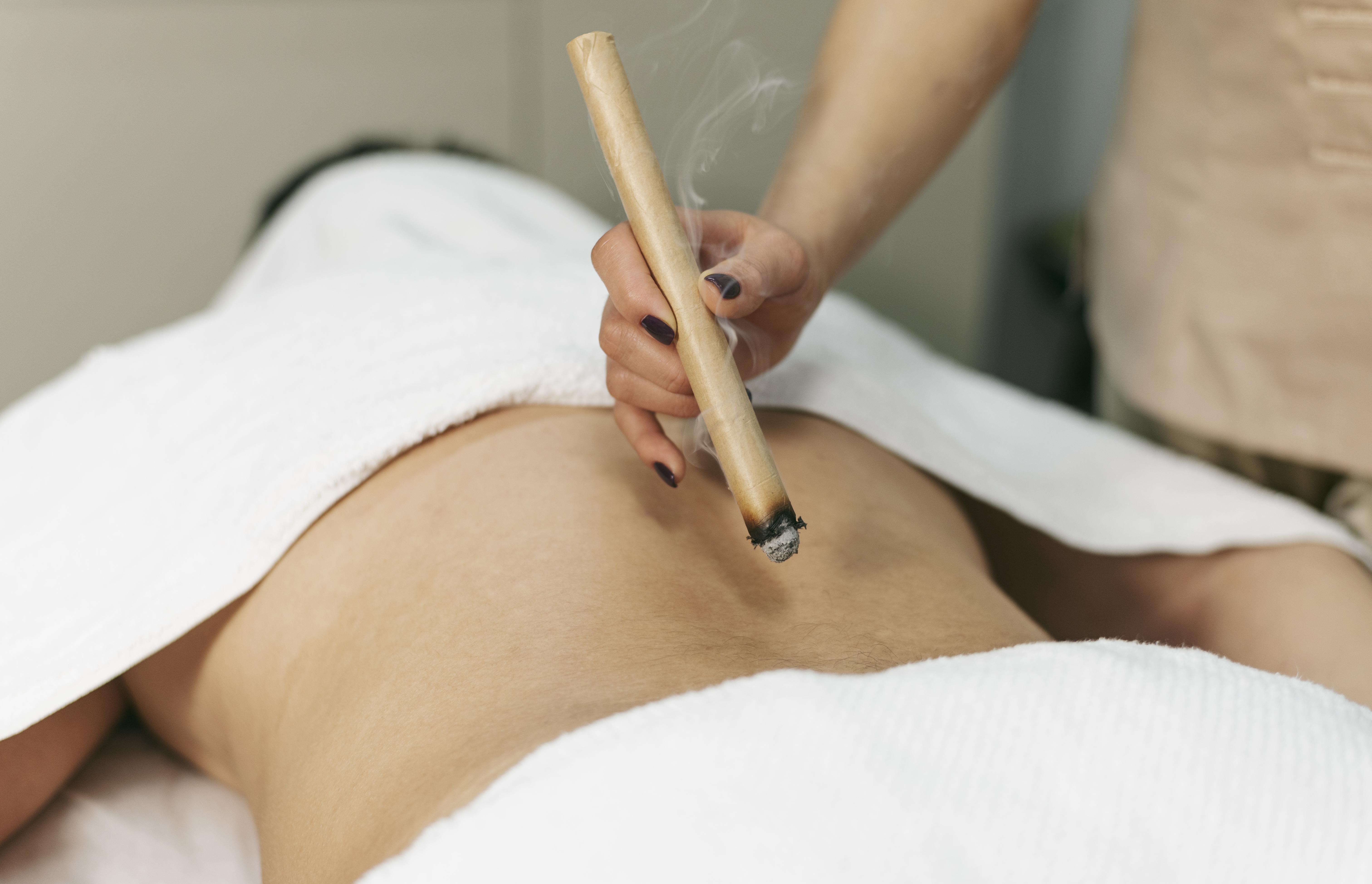 Moxibustion – technique de chaleur sur les points d'acupuncture