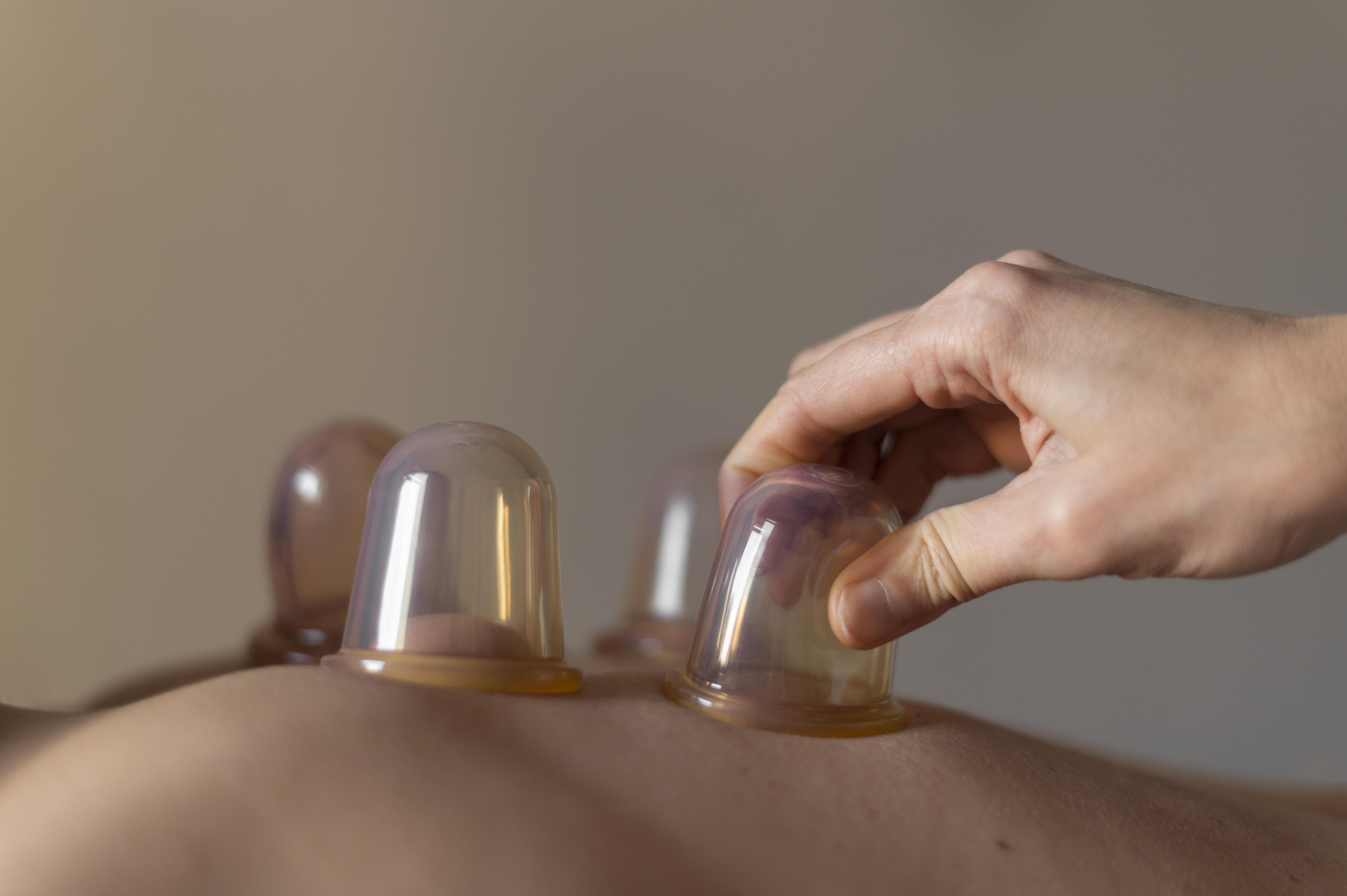 Thérapie par ventouses – débloquage des stagnations et soulagement musculaire
